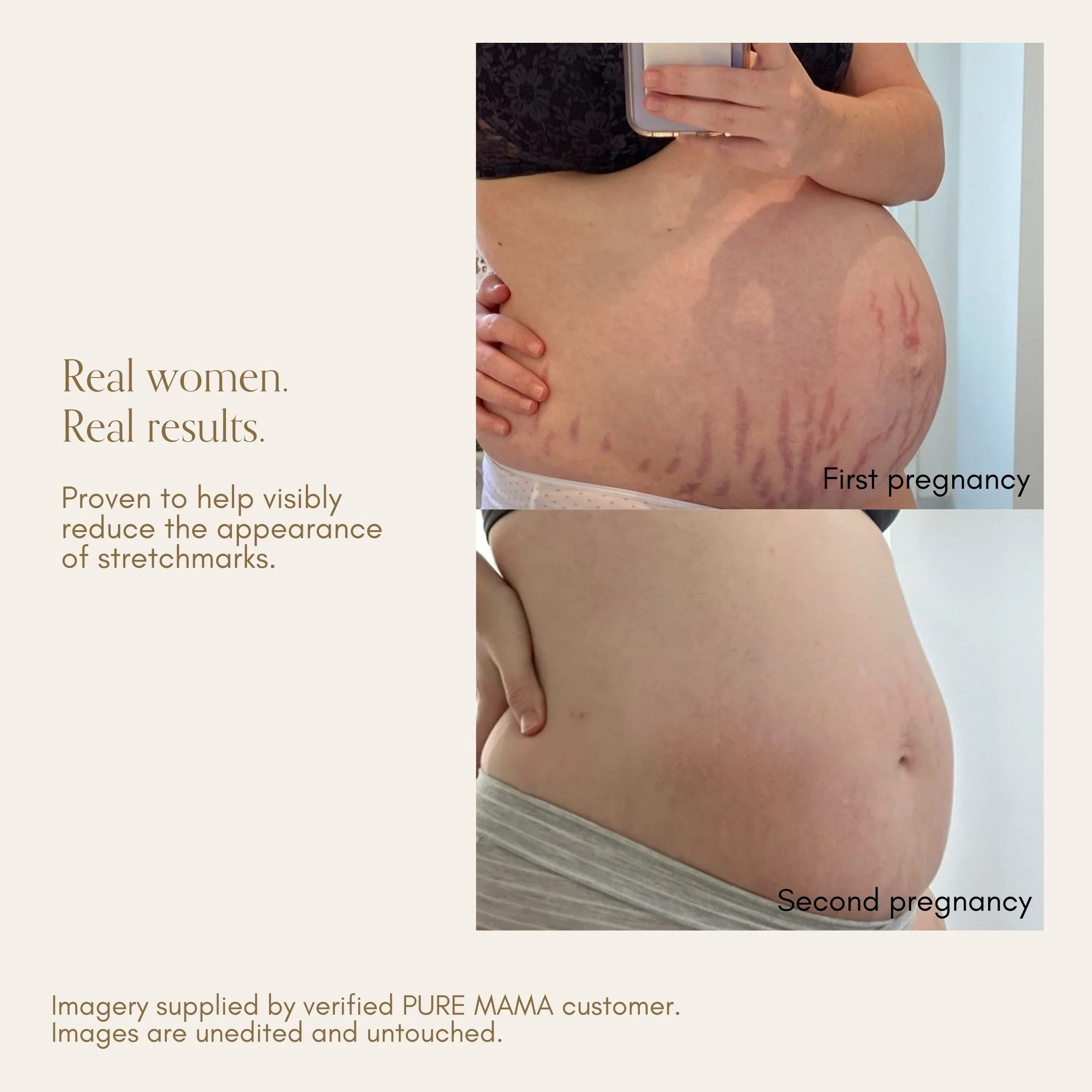Pure Mama Bump Love Set - Image 5
